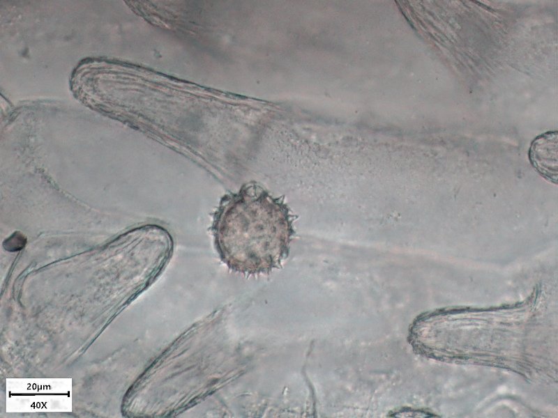 11_Petasites hybridus ex officinalis_Grandfontaine_2022_Pollen Olympus BH-2  Obj x40_002.jpg